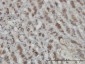 GMPPB Antibody (monoclonal) (M07)